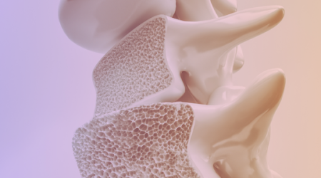 Immagine decorativa: Le evidenze che contano: scoperte sulla cura dell'osteoporosi